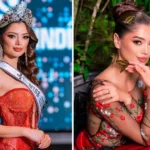 Miss Quindío Universal labio leporino certamen de belleza Colombia