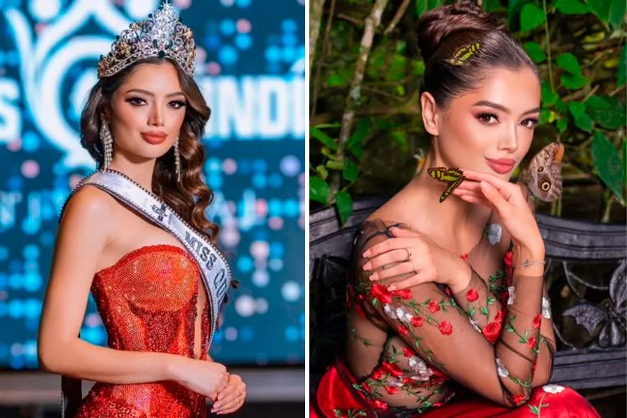 Miss Quindío Universal labio leporino certamen de belleza Colombia