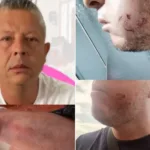 obra sin licencias Circasia pelea concejal