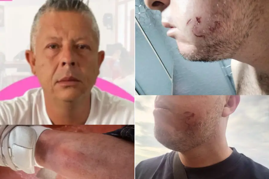 obra sin licencias Circasia pelea concejal